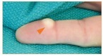 Finger Mass